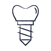 Implantes dentales
